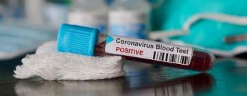 Bilanț CORONAVIRUS în România: 165 de cazuri noi în ultimele 24 de ore. Situația pe județe