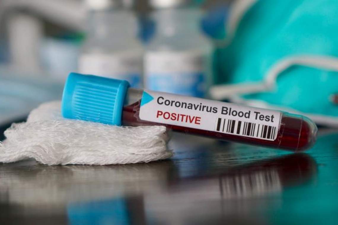 Coronavirus - Situația la zi în județul Prahova. Numărul persoanelor internate a crescut la 37