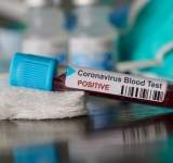 Bilanț CORONAVIRUS în România: 450 de cazuri noi în ultimele 24 de ore