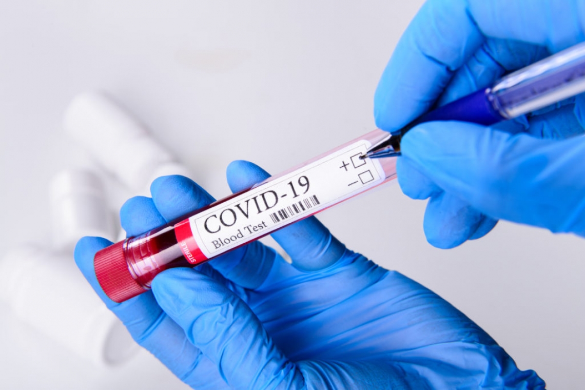 Testele rapide pentru depistarea infecției cu coronavirus pot duce în eroare mai ales pacienții asimptomatici