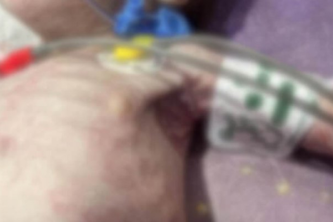 Caz cutremurător în Prahova! Un copil care suferă de malnutriție a ajuns în stare gravă la spital