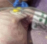 Caz cutremurător în Prahova! Un copil care suferă de malnutriție a ajuns în stare gravă la spital