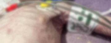 Caz cutremurător în Prahova! Un copil care suferă de malnutriție a ajuns în stare gravă la spital